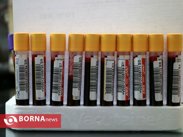 نذر خون شب دهم محرم