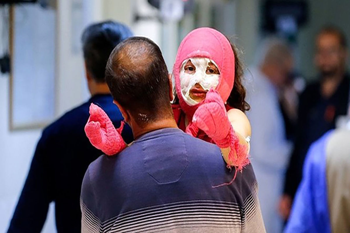 مصدومان چهارشنبه سوری در آذربایجان شرقی به ۳۳۲ نفر رسید