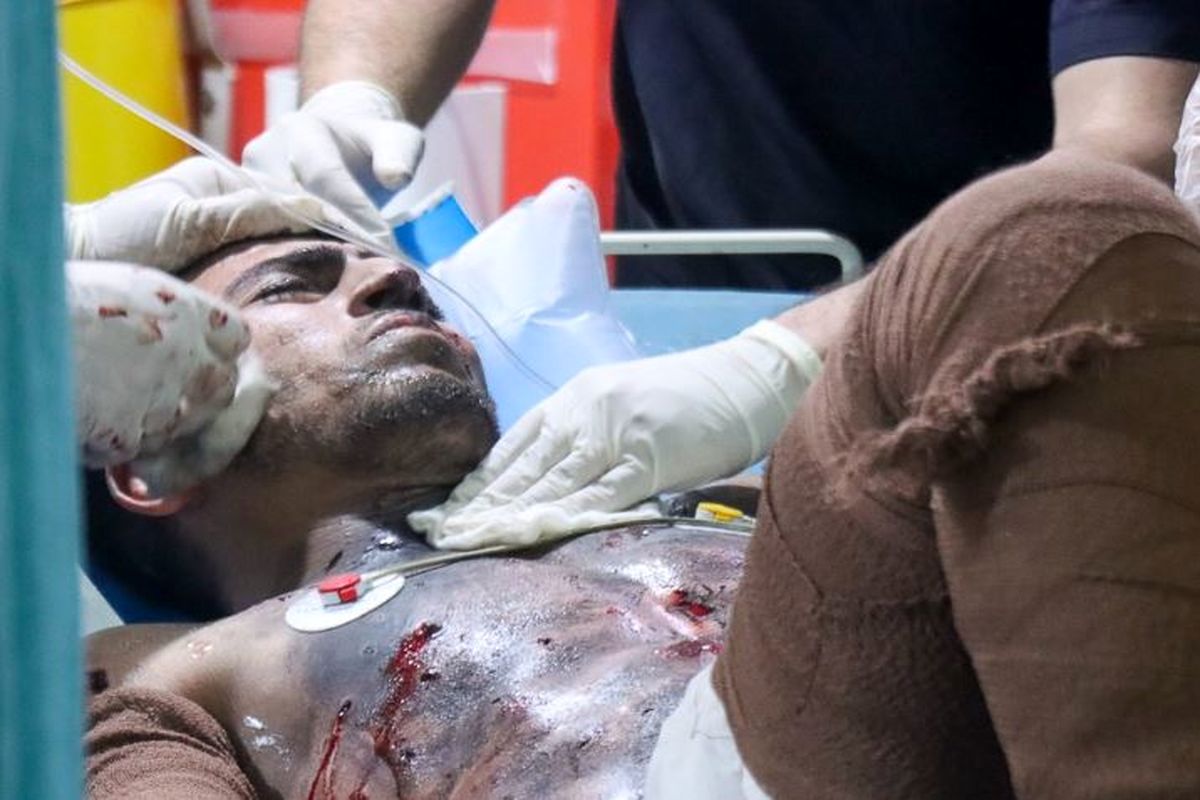 حوادث چهارشنبه سوری در قزوین 132 کشته و مجروح بر جای گذاشت